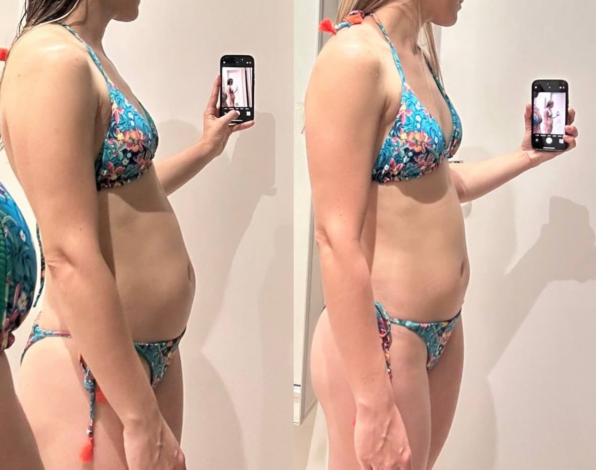 Antes e depois de uma participante do Detox 7 Dias