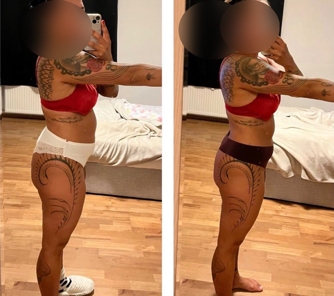 Antes e depois de uma participante do Detox 7 Dias