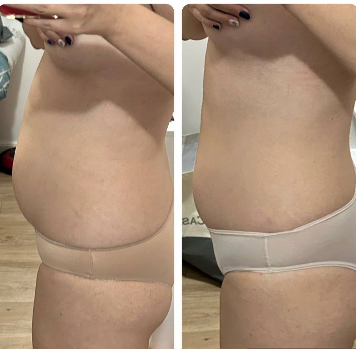 Antes e depois de uma participante do Detox 7 Dias